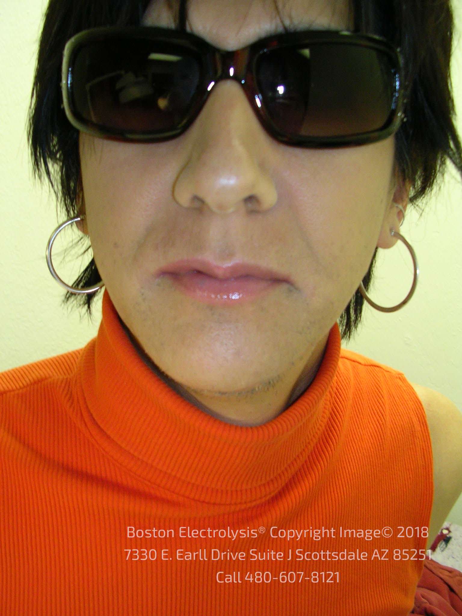 Before electrolysis — client 1