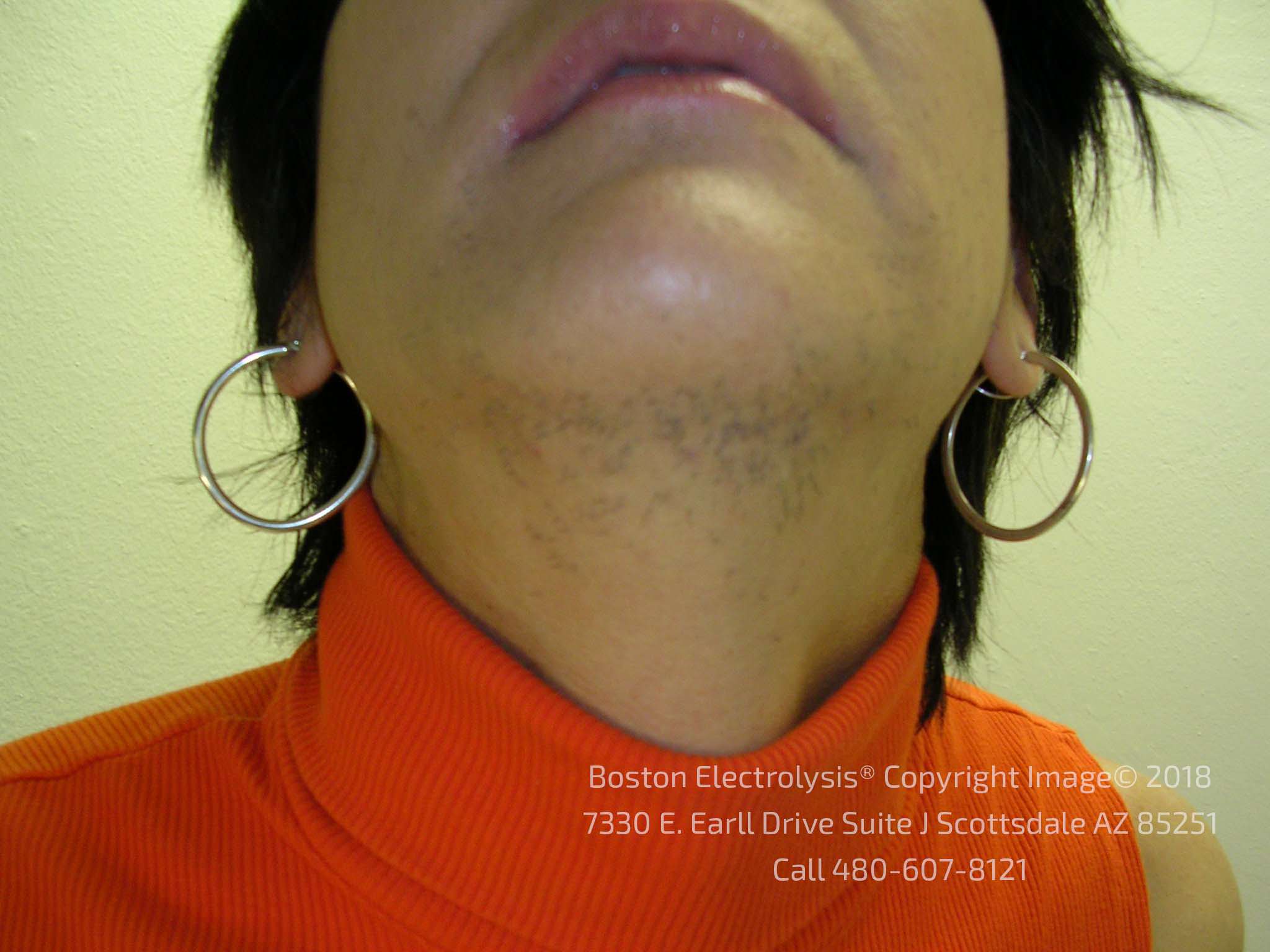 Before electrolysis — client 2