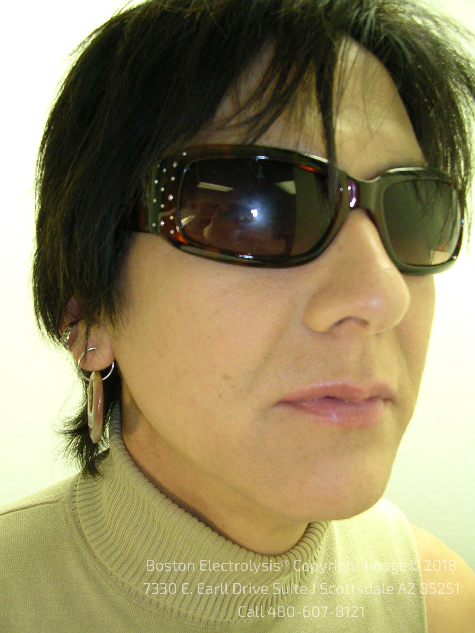 Before electrolysis — client 3